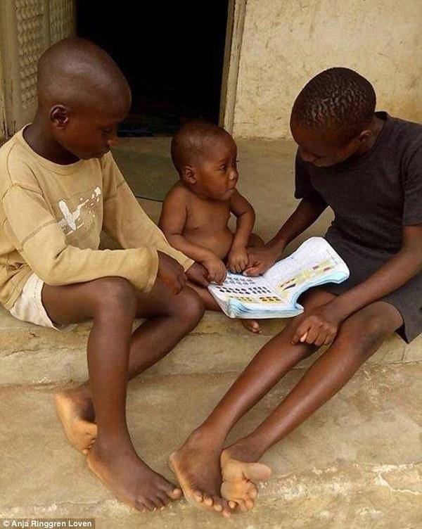 Нигерийский мальчик, брошенный умирать родителями, пошел на поправку Нигерия, Африка, Дети, мальчик, Hope, спасение, Anja Loven, длиннопост
